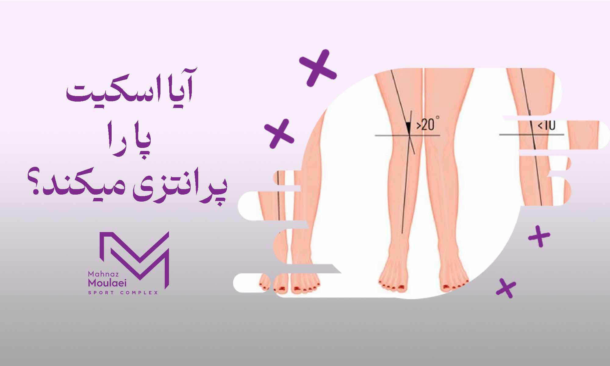 آیا اسکیت پا را پرانتزی می‌کند؟